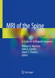 MRI of the Spine - Adam E. Flanders, John A. Carrino (ISBN: 9783030436292)