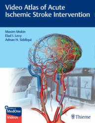 Video Atlas of Acute Ischemic Stroke Intervention - Elad Levy, Adnan Siddiqui (ISBN: 9781684202492)