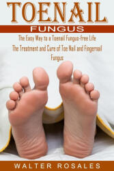Toenail Fungus (ISBN: 9781774854709)