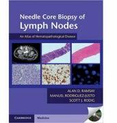 Needle Core Biopsy of Lymph Nodes with DVD-ROM: An Atlas of Hematopathological Disease - Alan D. Ramsay, Manuel Rodriguez-Justo, Scott J. Rodig (ISBN: 9781107624542)
