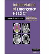 Interpretation of Emergency Head CT: A Practical Handbook - Erskine J. Holmes, Anna C. Forrest-Hay, Dr Rakesh R. Misra (ISBN: 9780521682428)