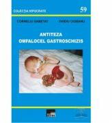 Antiteza omfalocel gastroschizis - Corneliu Sabetay, Ovidiu Ciobanu (ISBN: 9789731780948)