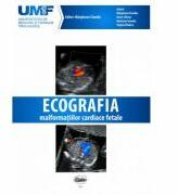 Ecografia Malformatiilor Cardiace Fetale. Brosura + DVD - Claudiu Marginean (ISBN: 9789731694566)