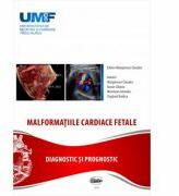Malformatii cardiace fetale - Claudiu Marginean (ISBN: 9789731694573)