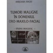 Tumori maligne in domeniul oro-maxilo-facial - Anisoara Hagiu (ISBN: 9789739266666)