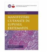 Manifestari cutanate in lupusul eritematos - Ionica-Mariana Radulescu (ISBN: 9786062718015)