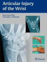 Articular Injury of the Wrist - Marc Garcia-Elias, Christophe Mathoulin (ISBN: 9783131746214)