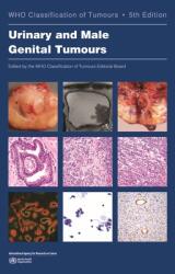Urinary and Male Genital Tumours (ISBN: 9789283245124)