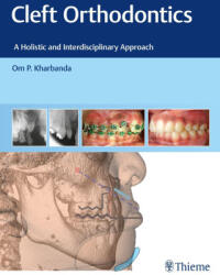 Cleft Orthodontics - Om P. Kharbanda (ISBN: 9788194857082)