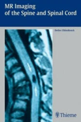 MR Imaging of the Spine and Spinal Cord - Detlev Uhlenbrock (2003)