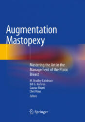 Augmentation Mastopexy - Chet Mays, Gaurav Bharti, Bill G. Kortesis (ISBN: 9783030482282)