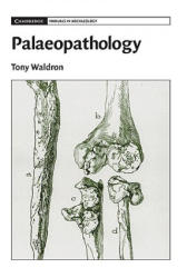 Palaeopathology - Tony Waldron (2012)