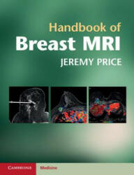Handbook of Breast MRI - Jeremy Price (2011)