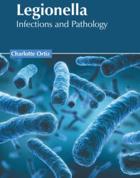 Legionella: Infections and Pathology (ISBN: 9781639893249)
