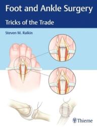 Foot and Ankle Surgery - Steven Raikin (ISBN: 9781626234918)