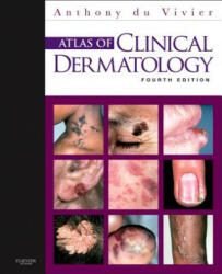 Atlas of Clinical Dermatology - Anthony Du Vivier (2012)