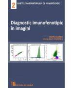 Diagnostic imunofenotipic in imagini - Doina Barbu (ISBN: 9789733908418)