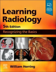 Learning Radiology - William Herring (ISBN: 9780323878173)