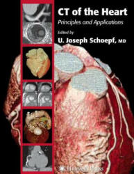 CT of the Heart - U. Joseph Schoepf (ISBN: 9781617374814)