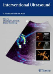 Interventional Ultrasound - Christoph Frank Dietrich, Dieter Nürnberg, Christoph Frank Dietrich (ISBN: 9783131708212)