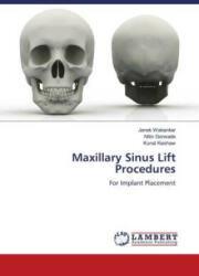 Maxillary Sinus Lift Procedures - Nitin Gorwade, Kunal Keshaw (ISBN: 9786204979946)