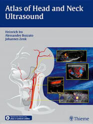 Atlas of Head and Neck Ultrasound - Heinrich Iro, Alessandro Bozzato, Johannes Zenk (2012)