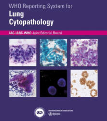 Who Reporting System for Lung Cytopathology (ISBN: 9789283245162)