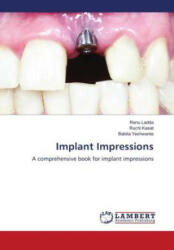 Implant Impressions - Ruchi Kasat, Babita Yeshwante (ISBN: 9786205510278)