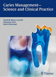Caries Management - Science and Clinical Practice - Hendrik Meyer-Lückel, Sebastian Paris, Kim R. Ekstrand (2013)