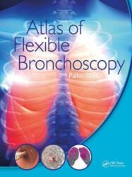 Atlas of Flexible Bronchoscopy - Pallav Shah (ISBN: 9781032477589)