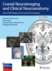 Cranial Neuroimaging and Clinical Neuroanatomy - Heinrich Lanfermann, Peter Raab, Hans-Joachim Kretschmann, Wolfgang Weinrich (ISBN: 9783136726044)