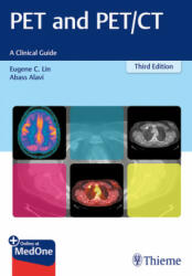 PET and PET/CT - Eugene C. Lin, Abass Alavi (ISBN: 9781626231344)