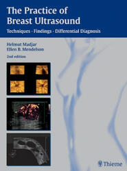 Practice of Breast Ultrasound - Helmut Madjar, Ellen B. Mendelson (ISBN: 9783131243423)
