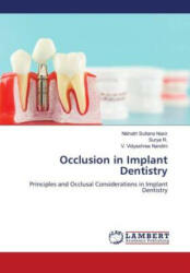 Occlusion in Implant Dentistry - Surya R. , V. Vidyashree Nandini (ISBN: 9786200091161)