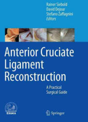 Anterior Cruciate Ligament Reconstruction - Rainer Siebold (ISBN: 9783662510834)