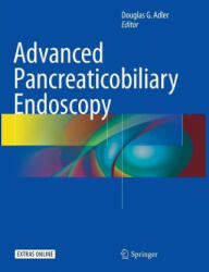 Advanced Pancreaticobiliary Endoscopy - DOUGLAS G. ADLER (ISBN: 9783319800257)