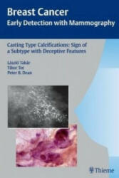 Casting-Type Calcifications: Sign of a Subtype with Deceptive Features - Peter B. Dean, Laszlo Tabar, Tibor Tot (ISBN: 9783131353917)