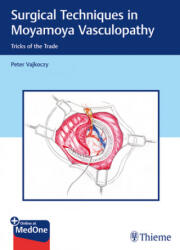 Surgical Techniques in Moyamoya Vasculopathy (ISBN: 9783131450616)
