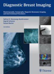 Diagnostic Breast Imaging - Sylvia H. Heywang-Koebrunner, Ingrid Schreer, Susan Barter (ISBN: 9783132431928)