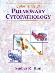 Color Atlas of Pulmonary Cytopathology - Sudha R. Kini, Samuel P. Hammar, P. Greensheet, M. J. Purslow (2002)