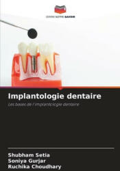 Implantologie dentaire - Soniya Gurjar, Ruchika Choudhary (ISBN: 9786206104001)