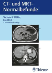 CT und MRT Normalbefunde - Emil Reif (ISBN: 9783132453074)