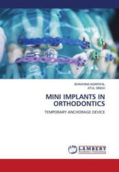 MINI IMPLANTS IN ORTHODONTICS - Atul Singh (ISBN: 9786206173038)