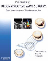 Carpentier's Reconstructive Valve Surgery - David H. Adams, Alain Carpentier, Farzan Filsoufi, Henry R. Kravis (ISBN: 9780721691688)