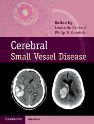 Cerebral Small Vessel Disease - Leonardo Pantoni, Philip B. Gorelick (ISBN: 9781107031661)