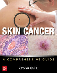 Skin Cancer: A Comprehensive Guide - Keyvan Nouri (ISBN: 9781260453003)