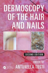 Dermoscopy of the Hair and Nails - Antonella Tosti (ISBN: 9781482234053)