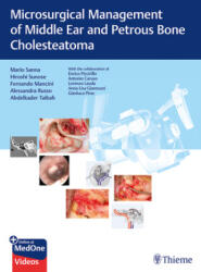 Microsurgical Management of Middle Ear and Petrous Bone Cholesteatoma - Mario Sanna, Hiroshi Sunose, Fernando Mancini, Alessandra Russo, Abdelkader Taibah (ISBN: 9783132000056)