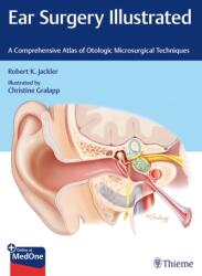 Ear Surgery Illustrated (ISBN: 9781684201105)