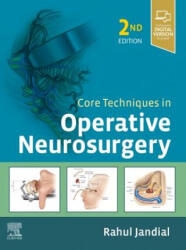 Core Techniques in Operative Neurosurgery (ISBN: 9780323523813)